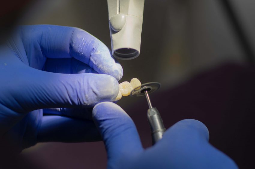 Implanty stomatologiczne - kto wymyślił?