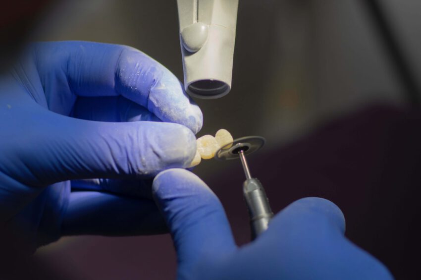 Implanty stomatologiczne - kto wymyślił?